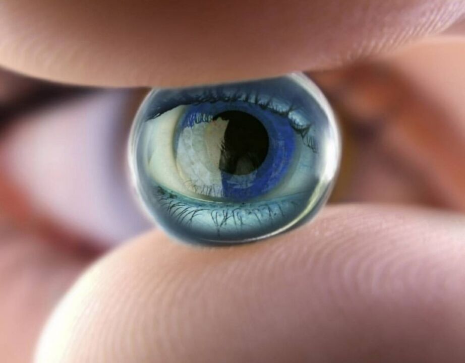 Orthokeratologische Nachtlinsen stoppen das Fortschreiten der Sehbehinderung